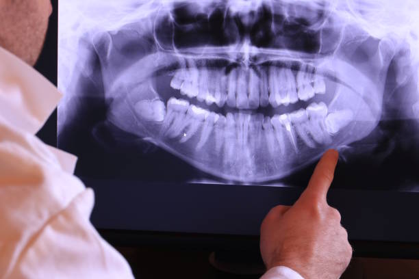 Best Emergency Dental Care for Trauma or Injury in Brady, TX